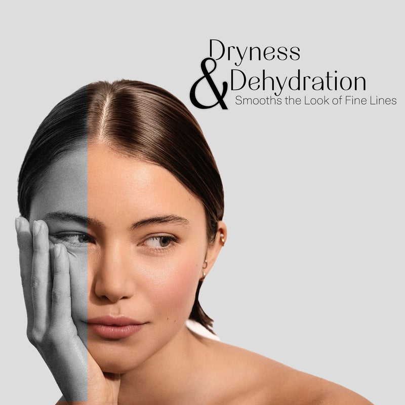 Dryness & Dehydration