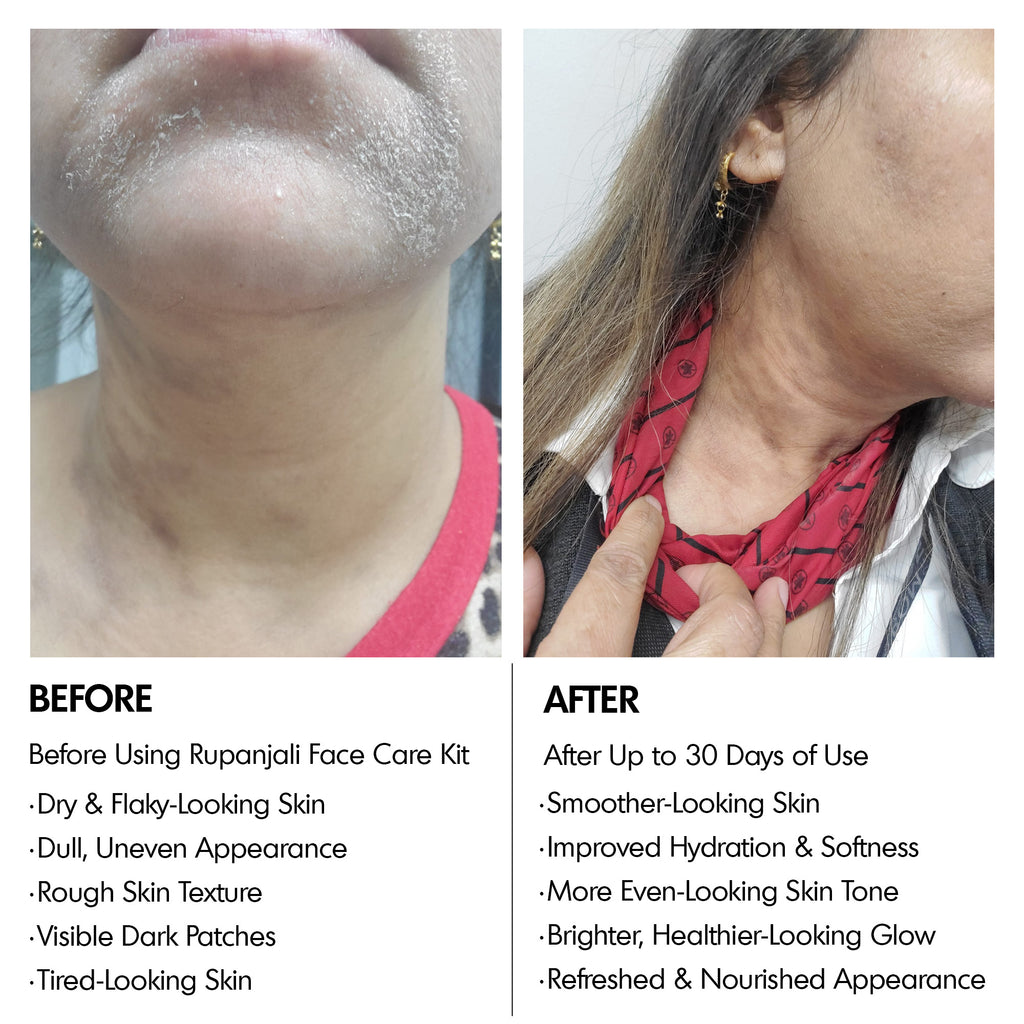 Rupanjali 5-in-1 Facial Kit – Extraordinary Organic Skin Care