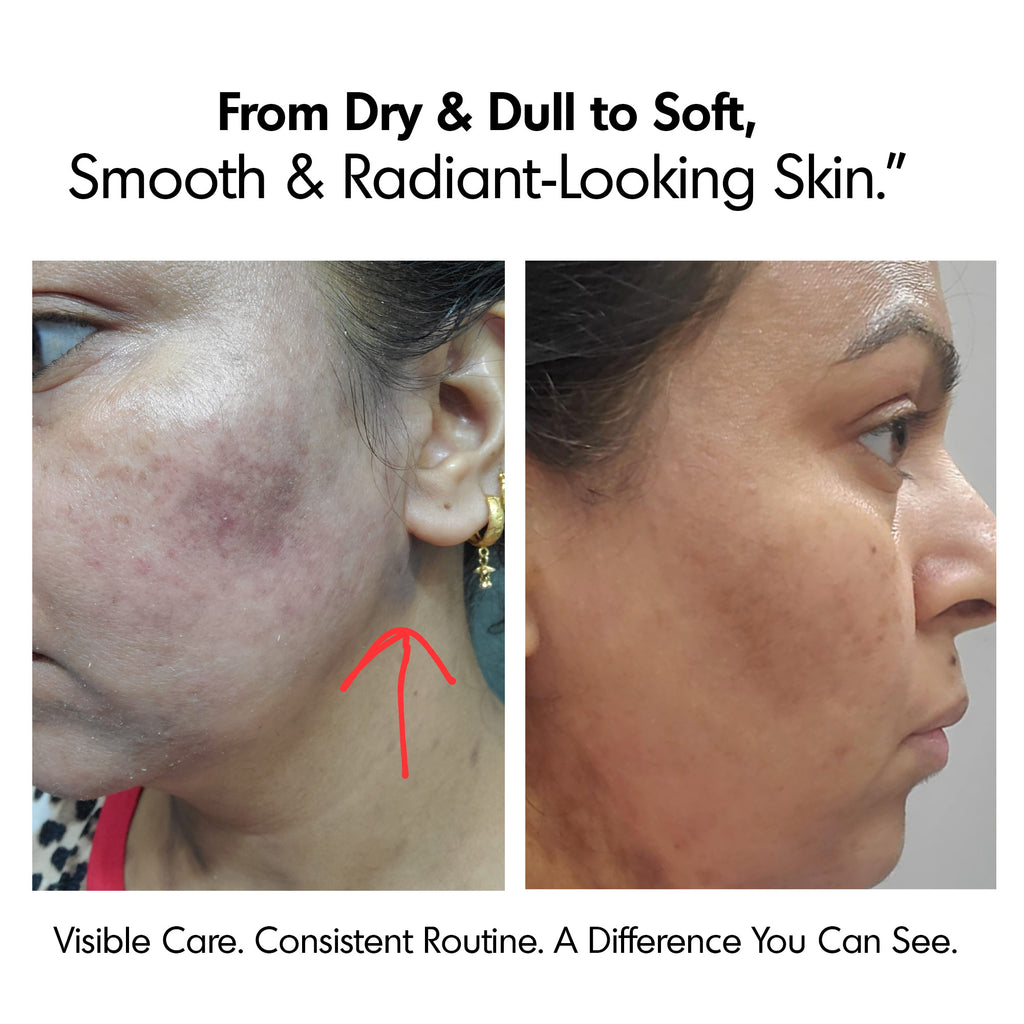 Rupanjali 5-in-1 Facial Kit – Extraordinary Organic Skin Care